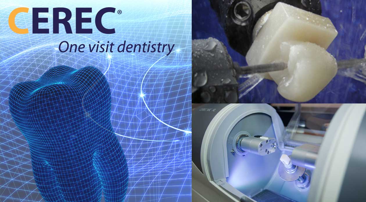 Технология изготовления cerec коронки презентация